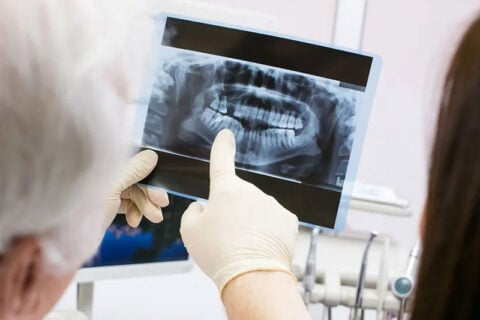 doctors referring to an x-ray