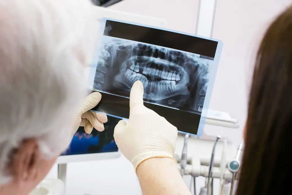 doctors referring to an x-ray