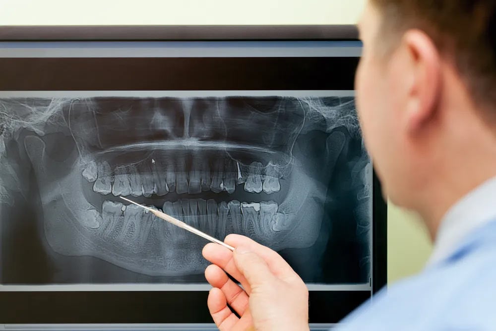 Doctor inspecting the x-ray